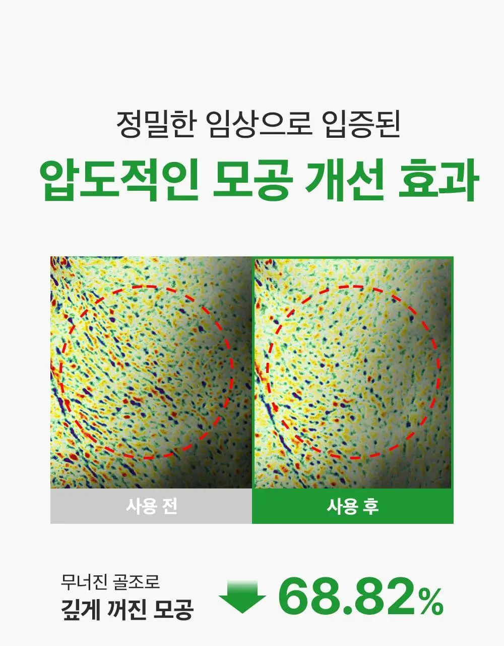 [모공딥클렌징] 성분에디터 그린토마토 딥 포어 클렌징 울트라 휘핑 폼 120g 상세페이지 45